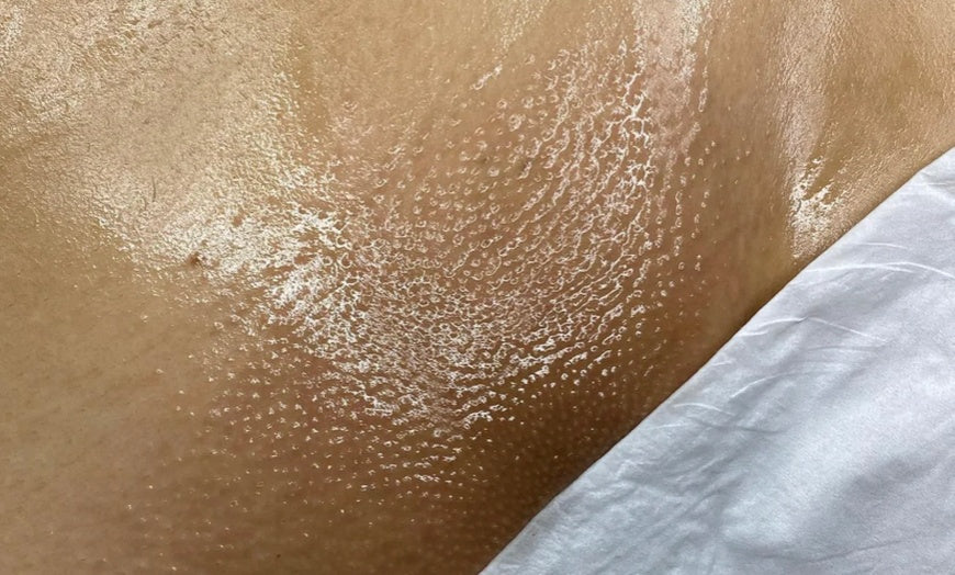 What Is a Brazilian Wax? Everything You Need to Know